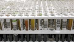 Imagen de archivo del CHUO de varias pruebas de orina.