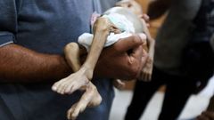 Un mdico palestino con el cuerpo de un beb muerto de inanicin.