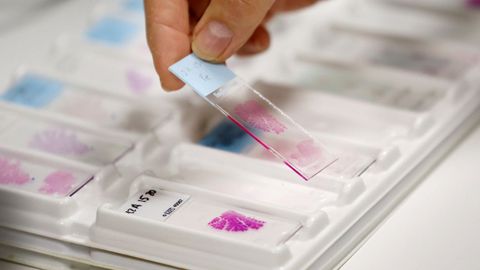 Muestras que requieren analizarse con el microscopio.