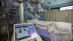 Cuidados cr�ticos de una persona con covid-19 ingresada en el Hospital Cl�nico, en foto de archivo