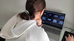 Las im�genes que los pacientes del Sergas pueden descargar tienen calidad diagn�stica