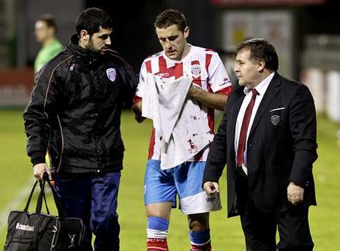 Seoane se perdi� los primeros minutos de la temporada tras recibir un golpe en la nariz. 