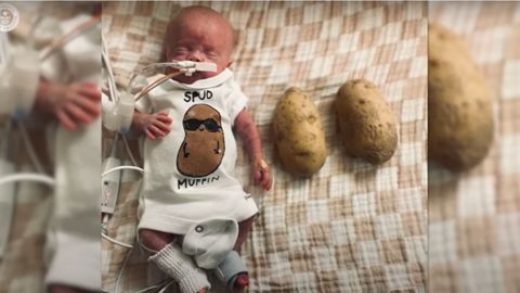 Nash Keen, el beb ms prematuro del mundo, cumple su primer ao de vida