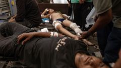 Palestinos heridos en el norte de Gaza.