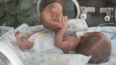 Fotografa de archivo de un beb prematuro en la uci peditrica de un hospital gallego