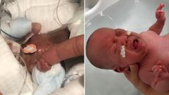 A la izquierda, el beb� cinco d�as despu�s de nacer con 268 gramos. A la derecha , el ni�o a punto de ser dado de alta con 3 kilos