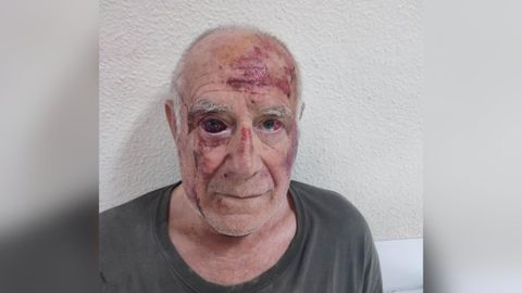 Domingo, tras ser agredido la mañana del miércoles en Torre Pacheco por un grupo de jóvenes.
