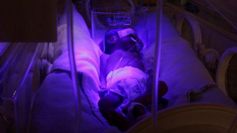 Un beb� reci�n nacido, recibiendo ox�geno en una incubadora en un hospital de Bolivia