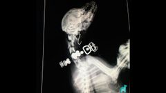 Radiograf�a de la perra que se trag� un anzuelo