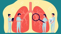 La EPOC se caracteriza por la obstrucci�n del aire que entra y sale de los pulmones, lo que causa dificultad para respirar.