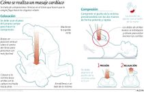 C�mo se realiza un masaje card�aco