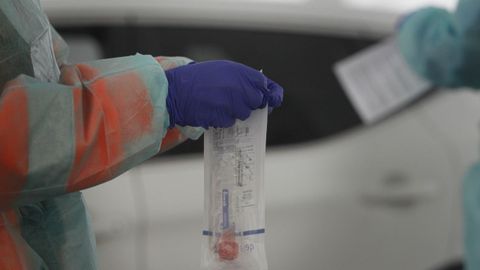 Primer plano de un test de coronavirus antes de ser realizada una prueba r�pida en Santiago