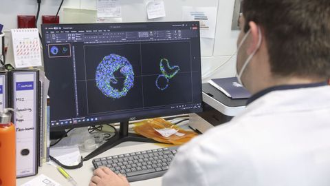Imagen del trabajo de un equipo de investigación contra el cáncer