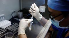 Un t�cnico de laboratorio manipula una muestra de semen