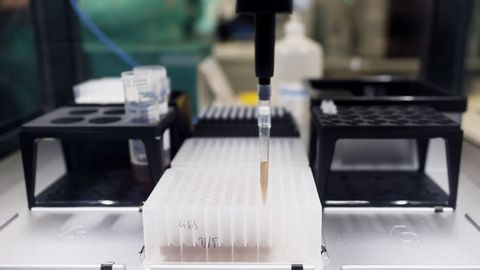 Pipetas con muestras para hacer PCR en el Hospital Gregorio Maran, de Madrid