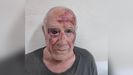Domingo, tras ser agredido la mañana del miércoles en Torre Pacheco por un grupo de jóvenes.