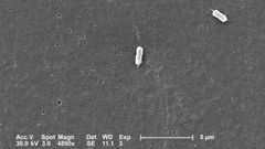 Imagen microsc�pica de la bacteria