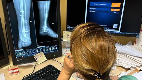 Los centros del área sanitaria de Pontevedra y O Salnés inician la implantación de la inteligencia artificial para informar radiografías simples de huesos