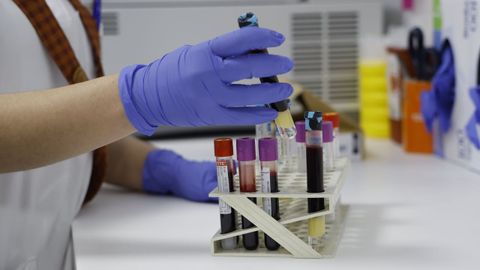 La enfermera Laura Fernández Castelo recoge las muestras.