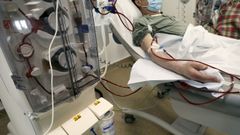 Imagen de archivo de un paciente en una sesi�n de di�lisis renal. 