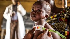 Personal sanitario toma medidas a un ni�o en el marco del programa contra la desnutrici�n del Programa Mundial de Alimentos, en la Rep�blica Democr�tica del Congo
