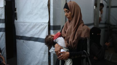 Una mujer sostiene en brazos a su hija de ocho meses, que padece desnutrición grave, en la ciudad de Gaza