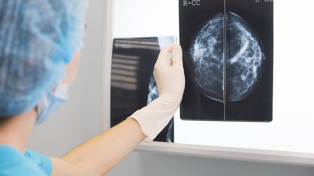 Sanidad aprueba la ampliación del cribado de cáncer de mama a mujeres de entre 45 y 74 años