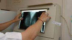 Mamografía realizada en Ourense