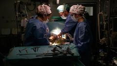 Imagen de archivo de una operaci�n en el Chuac