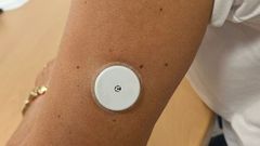 Un paciente, en el Chuac con el snsor para la monitorizaci�n de la glucosa en diab�ticos