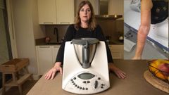 A la izquierda, Natalia, con la Thermomix con la que se quem� y, a la derecha, las quemaduras en uno de sus brazos.
