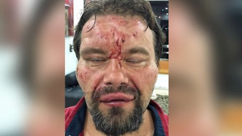 Imagen difundida por el Sindicato Nacional de Trabajadores de la Prensa de Venezuela del periodista polaco tras ser liberado 