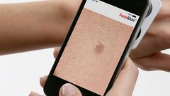 Fotoskin H