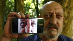 Domingo �lvarez, este viernes en Pontevedra, muestra su ojo morado despu�s de la agresi�n que sufri� el pasado s�bado