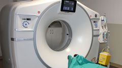 Imagen de archivo de un TAC del Hospital HM Modelo de A Coru�a