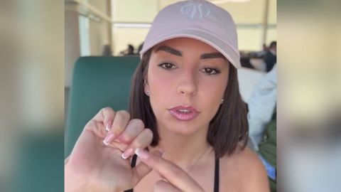 Anita Williams muestra su dedo amputado