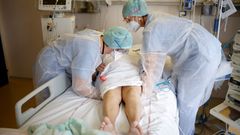 Un paciente covid, en la unidad de ciudados intensivos del hospital de Le Mans, en Francia