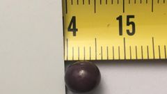 Esta es la perla encontrada en una sopa de almejas en un restaurante de Oviedo