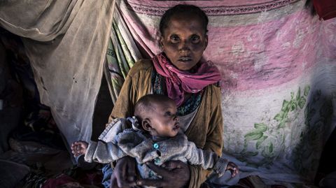 Una madre sostiene a su hija desnutrida en Amboasary, Madagascar, uno de los países más pobres del planeta.