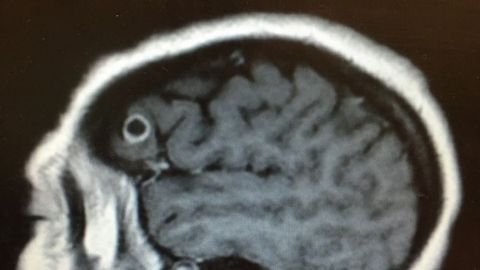 Esc�ner cerebral de Rachel