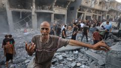 Imagen de un hombre afectado por los ataques israel�s de este lunes en Gaza.