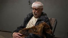 Un hombre herido durante el bombardeo de Rusia sobre Kiev