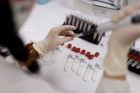 El nuevo test sera más fiable que las pruebas rapidas de anticuerpos
