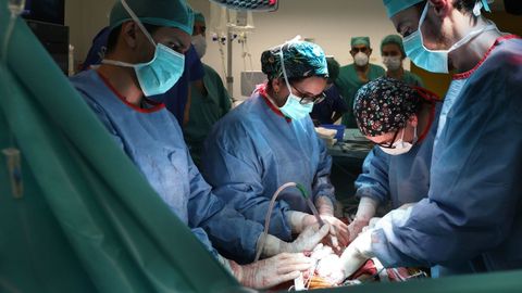 Trasplante de coraz&oacute;n en el Chuac, realizado en enero del pasado a&ntilde;o