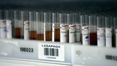 El LAboratorio Regional de Sanidad Animal acreditado de Lugo remiti� la muestra a Algete