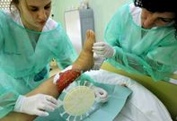 Los ap�sitos y tratamientos recrean la funci�n y el nivel de humedad de la propia piel.