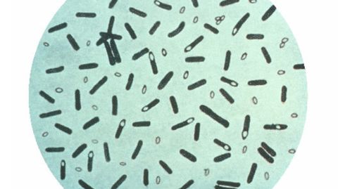 Bacteria del botulismo.