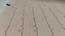 Imagen de archivo de un electrocardiograma.