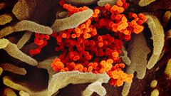 virus