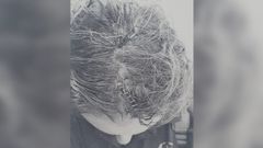 Foto de las lesiones sufridas en la cabeza